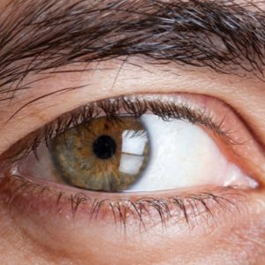 Cirugía de glaucoma